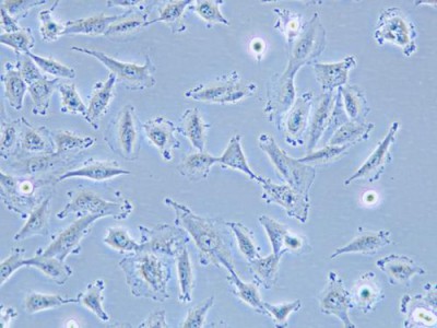 干细胞：修复人体的“万能细胞”